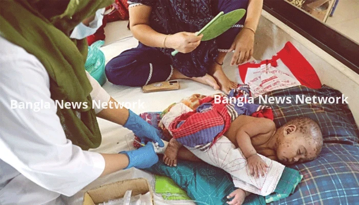 হামে শিশুমৃত্যু উদ্বেগজনকভাবে বাড়ছে, ১৮ জেলায় জরুরি টিকাদান কর্মসূচি